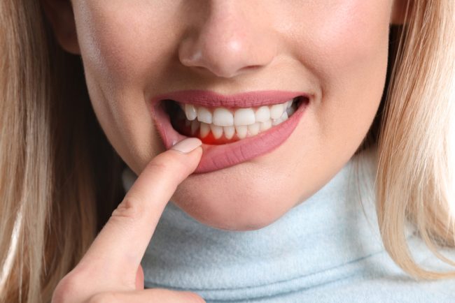 gum disease treatment spirit lake Dr. Darren Dotson D.D.S. Dr. Amy Hartzell D.D.S. Hill Avenue Dental. General, Cosmetic, Restorative, Preventative, Family Dentistry Dentist in Spirit Lake, IA 51360 gum disease treatment spirit lake Dr. Darren Dotson D.D.S. Dr. Amy Hartzell D.D.S. Hill Avenue Dental. General, Cosmetic, Restorative, Preventative, Family Dentistry Dentist in Spirit Lake, IA 51360