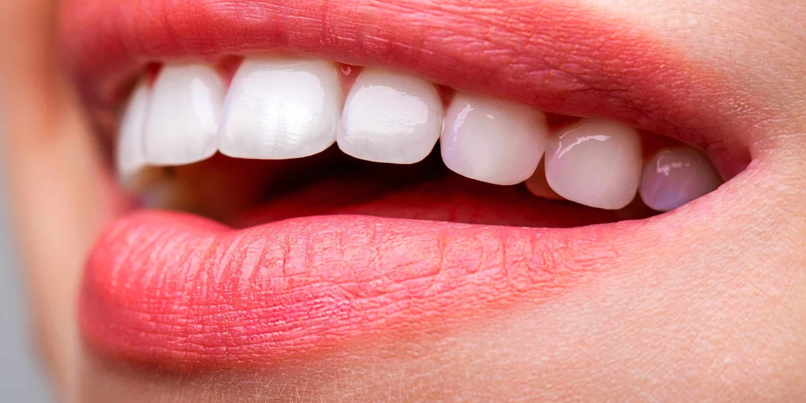 teeth whitening near me