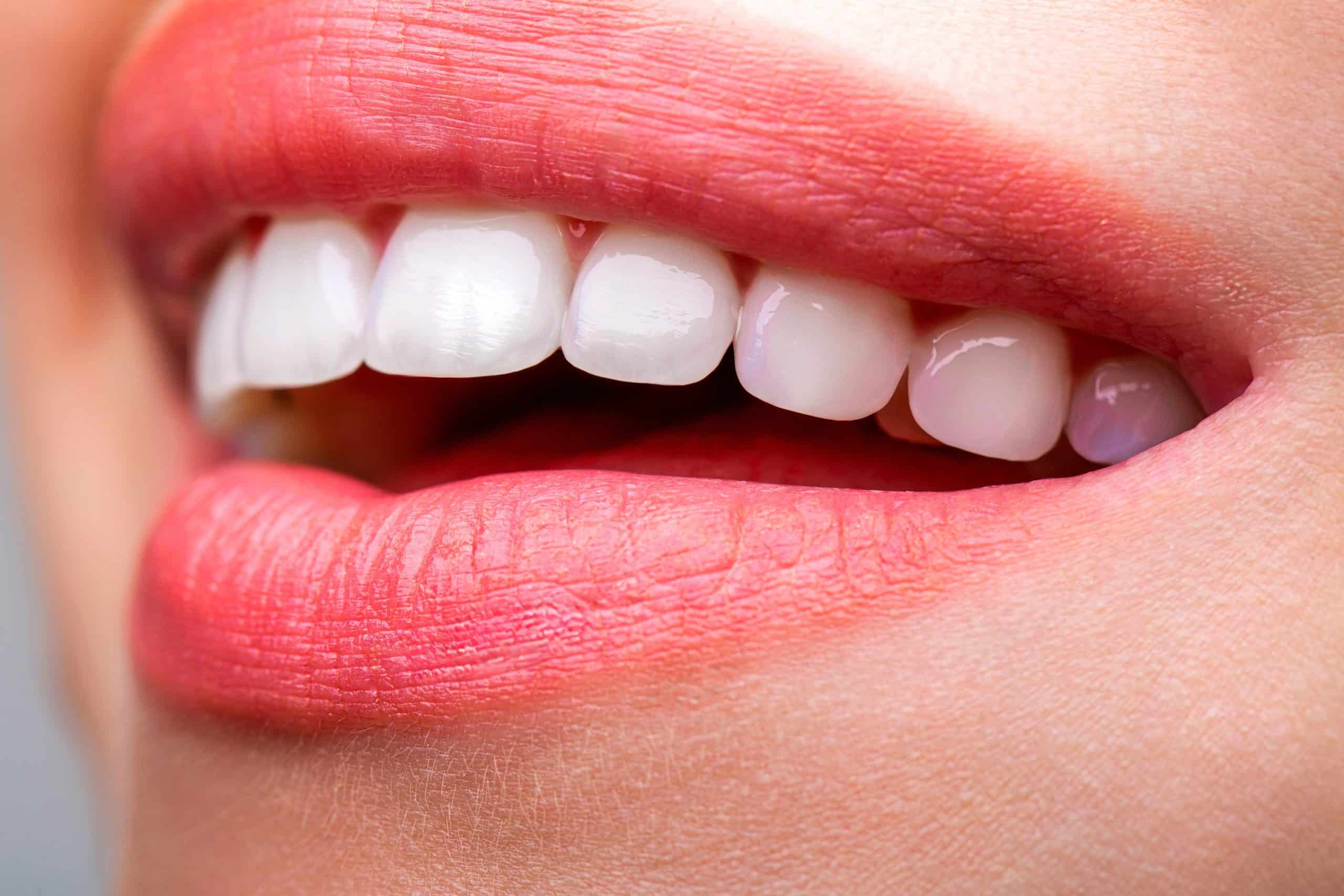 teeth whitening near me