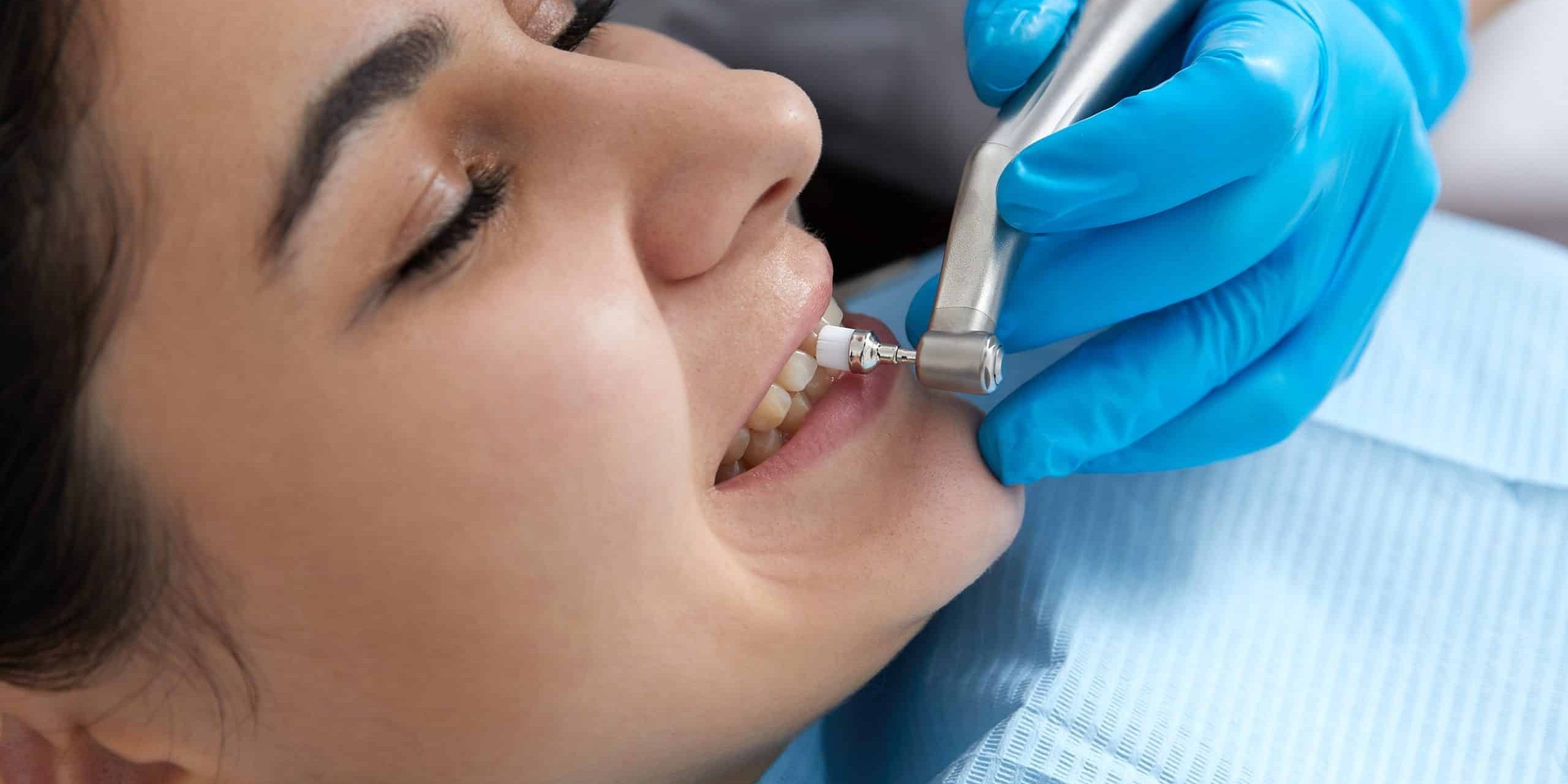 dental cleanings spirit lake